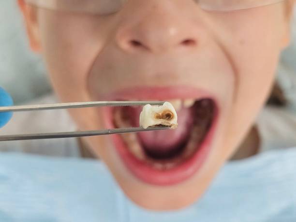 Best Broken Tooth Emergency  in Oakdale, PA